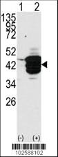 Anti-HDAC11 Rabbit Polyclonal Antibody