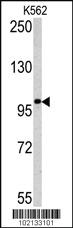 Anti-MAGEC1 Rabbit Polyclonal Antibody