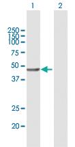 Anti-VPS36 Mouse Polyclonal Antibody