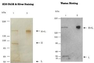 Anti-Tetanus Toxin Antibod