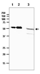 Anti-DNA Photolyase Antibody