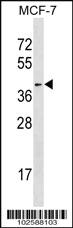 Anti-HDAC11 Rabbit Polyclonal Antibody