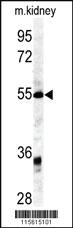 Anti-RLN1/RLN2 Rabbit Polyclonal Antibody