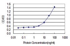 Anti-PCK1 Polyclonal Antibody Pair