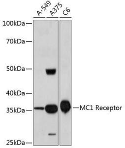 Western blot analysis of extracts of various cell lines, using Anti-MC1-R Antibody [ARC0638] (A80622) at 1:1,000 dilution The secondary antibody was Goat Anti-Rabbit IgG H&L Antibody (HRP) at 1:10,000 dilution Lysates/proteins were present at 25 µg per lane