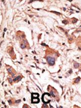 Anti-MAGED1 Rabbit Polyclonal Antibody