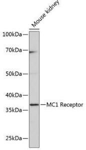 Western blot analysis of extracts of Mouse kidney, using Anti-MC1-R Antibody [ARC0638] (A80622) at 1:1,000 dilution The secondary antibody was Goat Anti-Rabbit IgG H&L Antibody (HRP) at 1:10,000 dilution Lysates/proteins were present at 25 µg per lane