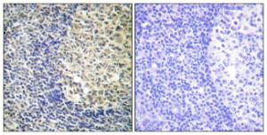 Immunohistochemical analysis of paraffin-embedded human tonsil using Anti-p47 phox (phospho Ser370) Antibody. The right hand panel represents a negative control, where the antibody was pre-incubated with the immunising peptide.