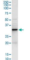 Anti-LGALS3 Rabbit Polyclonal Antibody