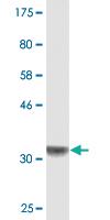 Anti-PRELID1 Mouse Monoclonal Antibody [clone: 6G1]