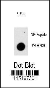 Anti-GFAP Rabbit Polyclonal Antibody (HRP (Horseradish Peroxidase))