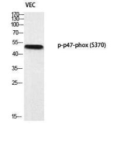 Western blot analysis of VEC using Anti-p47 phox (phospho Ser370) Antibody