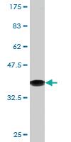 Anti-CTNNBIP1 Mouse Monoclonal Antibody [clone: 5C6]