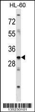 Anti-HOXB9 Rabbit Polyclonal Antibody (Biotin)