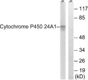 Anti-CYP24A1 Rabbit Polyclonal Antibody