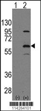 Anti-ELP3 Rabbit Polyclonal Antibody