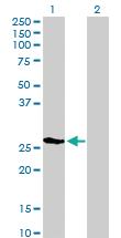 Anti-LGALS3 Rabbit Polyclonal Antibody