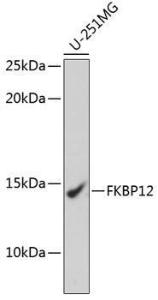 Anti-FKBP12 Rabbit Monoclonal Antibody [clone: ARC0654]