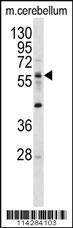 Anti-ELP3 Rabbit Polyclonal Antibody