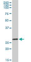 Anti-LGALS3 Rabbit Polyclonal Antibody