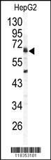 Anti-ARSB Rabbit Polyclonal Antibody