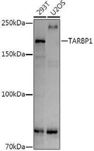 Western blot analysis of extracts of various cell lines, using Anti-TARBP1 Antibody (A308393) at 1:1,000 dilution The secondary antibody was Goat Anti-Rabbit IgG H&L Antibody (HRP) at 1:10,000 dilution Lysates/proteins were present at 25 µg per lane