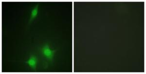 Immunofluorescence analysis of NIH/3T3 cells using Anti-MDM2 Antibody. The right hand panel represents a negative control, where the antibody was pre-incubated with the immunising peptide.