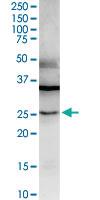 Anti-LGALS3 Rabbit Polyclonal Antibody