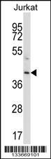 Anti-PROC Rabbit Polyclonal Antibody