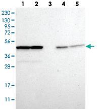 Anti-PSMC5 Rabbit Polyclonal Antibody