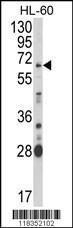 Anti-ARSB Rabbit Polyclonal Antibody (AP (Alkaline Phosphatase))