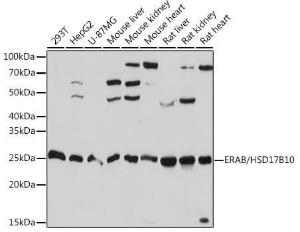 Anti-ERAB Rabbit Monoclonal Antibody [clone: ARC1852]