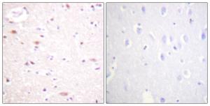 Immunohistochemical analysis of paraffin-embedded human brain using Anti-CDC16 (phospho Ser560) Antibody. The right hand panel represents a negative control, where the antibody was pre-incubated with the immunising peptide.