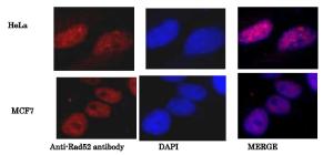 Anti-Rad52 Antibody