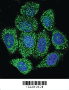 Anti-IMPDH1 Rabbit Polyclonal Antibody