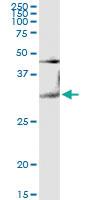 Anti-LGALS3 Rabbit Polyclonal Antibody