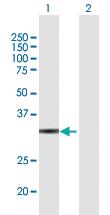 Anti-GLOD4 Mouse Polyclonal Antibody