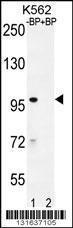 Anti-IQCA1 Rabbit Polyclonal Antibody (HRP (Horseradish Peroxidase))