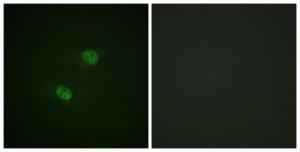 Immunofluorescence analysis of HeLa cells using Anti-CDC16 (phospho Ser560) Antibody. The right hand panel represents a negative control, where the antibody was pre-incubated with the immunising peptide.