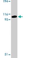 Anti-TLR2 Rabbit Polyclonal Antibody