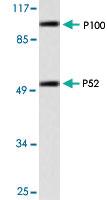 Anti-NFKB1 Rabbit Polyclonal Antibody