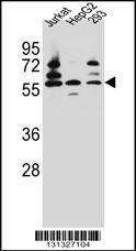 Anti-PDP1 Rabbit Polyclonal Antibody (Biotin)