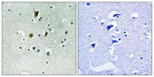 Immunohistochemical analysis of paraffin-embedded human brain using Anti-CDC16 (phospho Ser560) Antibody 1:100 (4°C overnight). The right hand panel represents a negative control, where the antibody was pre-incubated with the immunising peptide.