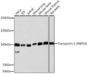 Western blot analysis of extracts of various cell lines, using Anti-TNPO3 Antibody [ARC2310] (A308395) at 1:1000 dilution