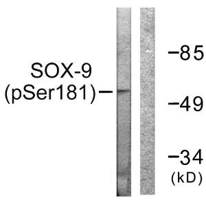 Western blot analysis of lysates from 293 cells treated with PBS 60' using Anti-SOX-9 (phospho Ser181) Antibody. The right hand lane represents a negative control, where the antibody is blocked by the immunising peptide