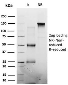 SDS-PAGE analysis of Anti-MED7 Antibody [PCRP-MED7-1B8] under non-reduced and reduced conditions; showing intact IgG and intact heavy and light chains, respectively. SDS-PAGE analysis confirms the integrity and purity of the Antibody