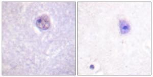 Immunohistochemical analysis of paraffin-embedded human brain using Anti-SOX-9 (phospho Ser181) Antibody. The right hand panel represents a negative control, where the antibody was pre-incubated with the immunising peptide