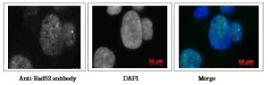 Anti-Rad52 Antibody