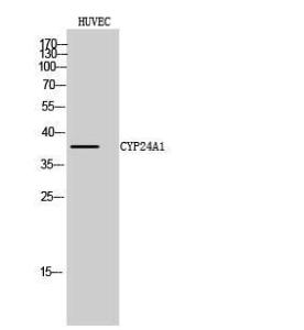 Anti-CYP24A1 Rabbit Polyclonal Antibody