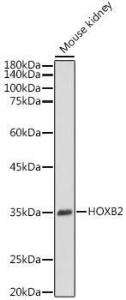 Western blot analysis of extracts of Mouse kidney, using Anti-HOXB2 Antibody (A305784) at 1:1,000 dilution The secondary antibody was Goat Anti-Rabbit IgG H&L Antibody (HRP) at 1:10,000 dilution Lysates/proteins were present at 25 µg per lane